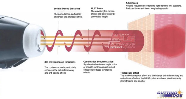 cold-laser-therapy