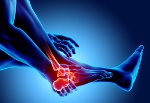 How Chiropractic Care Supports Relief from Psoriatic Arthritis