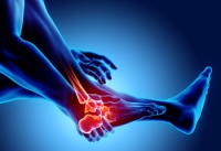 How Chiropractic Care Supports Relief from Psoriatic Arthritis